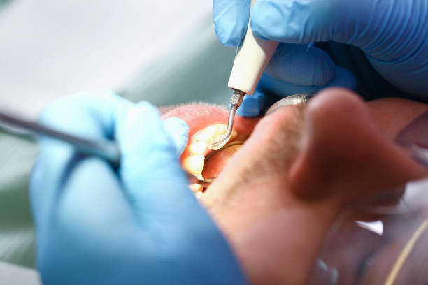 Best Urgent Care for Lost Fillings or Crowns in Harbor Springs, MI
